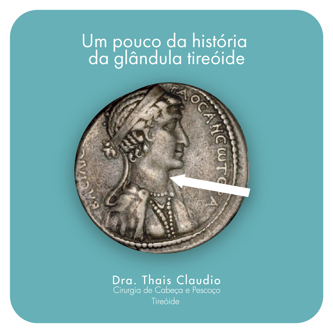 cleopatra-bocio-glandula-tireoide